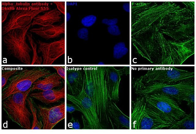 Rabbit IgG (H+L) Highly Cross-Adsorbed Secondary Antibody in Immunocytochemistry (ICC/IF)