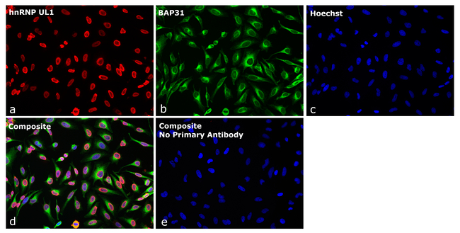 Goat IgG (H+L) Highly Cross-Adsorbed Secondary Antibody in Immunocytochemistry (ICC/IF)