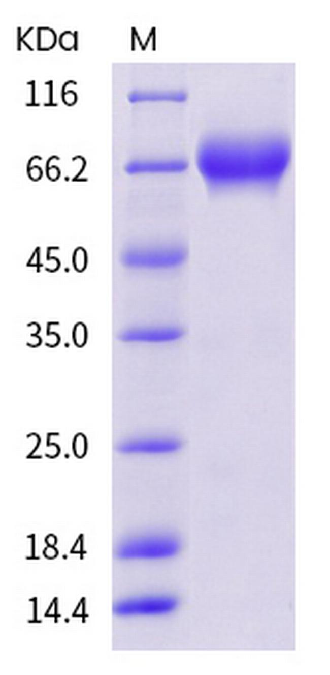 Human PD-L1 (B7-H1) Fc Chimera Protein