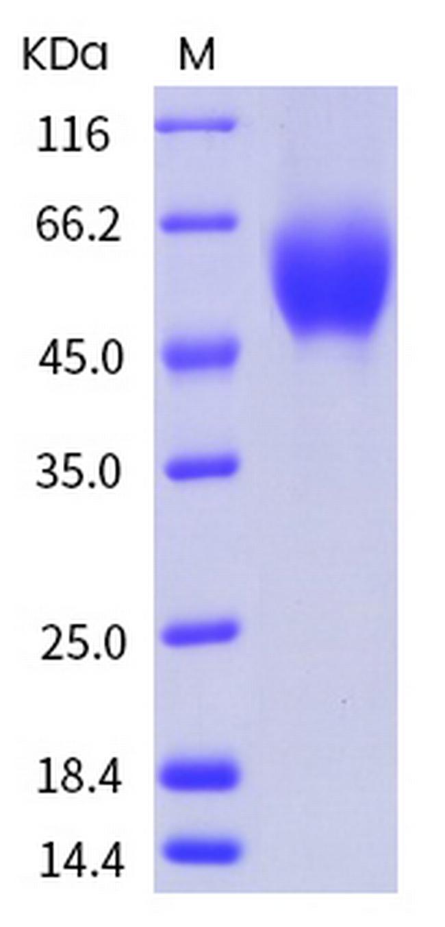 Human CD155 (PVR) His-tag Protein