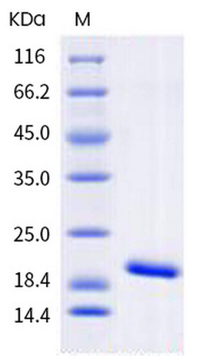 Human IL-1 beta Protein