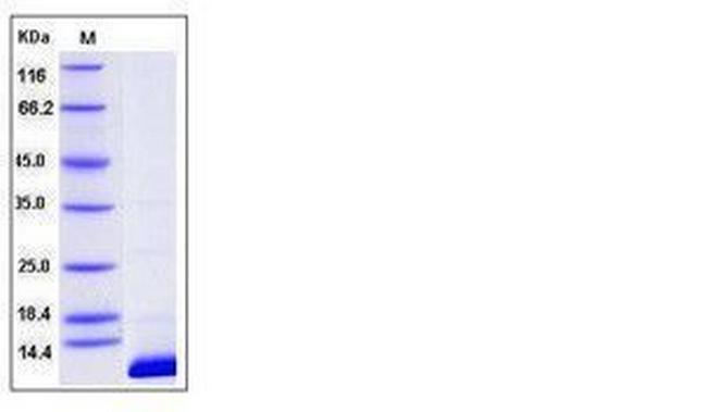 Human S100B His-tag Protein