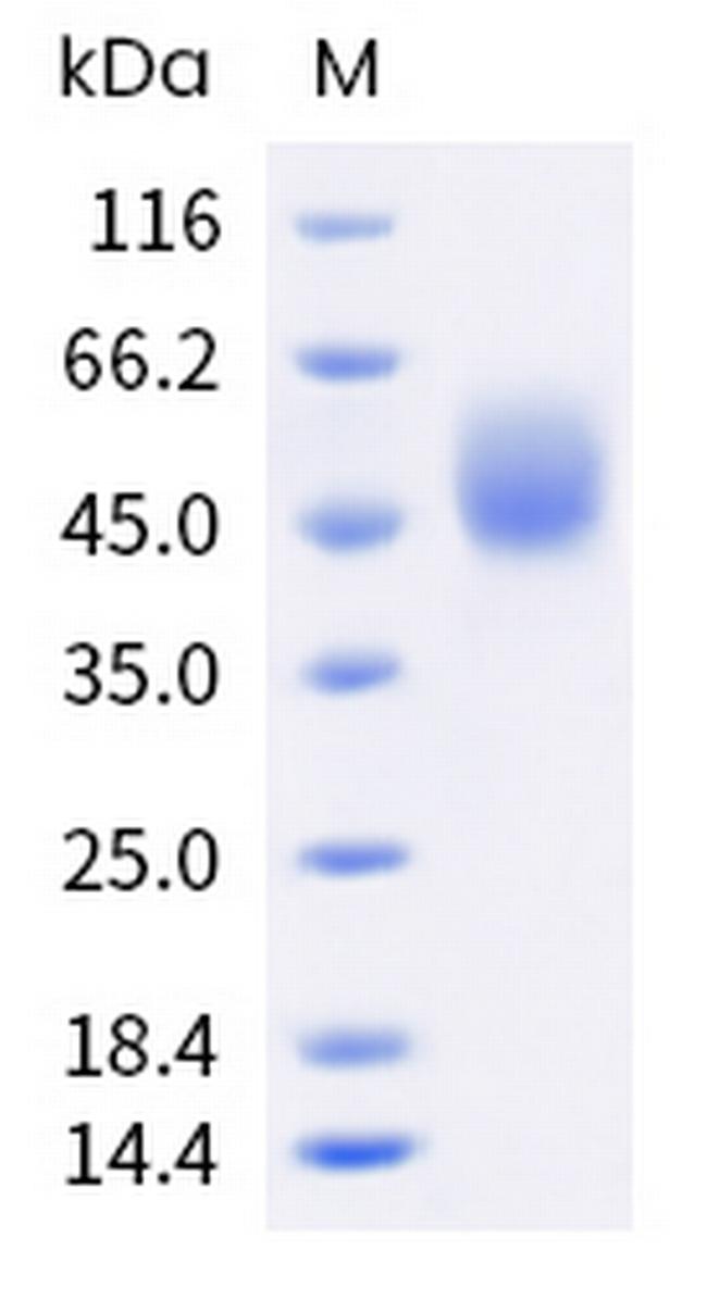 Human Fc gamma RI (CD64) His-tag Protein
