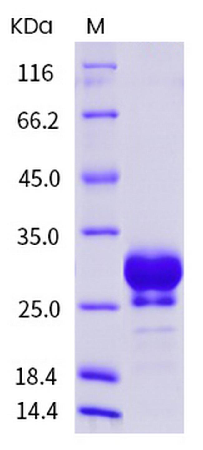 Human Fc gamma RIIB (CD32b) His-tag Protein
