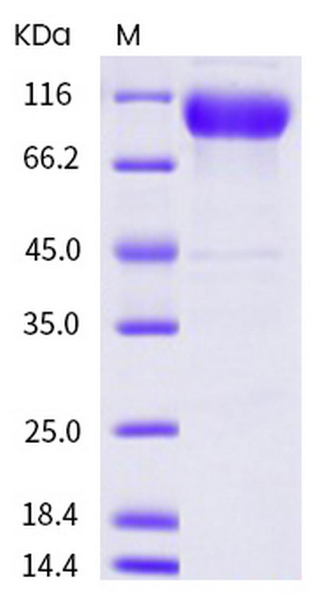 Human ICAM-1 (CD54) His-tag Fc Chimera Protein