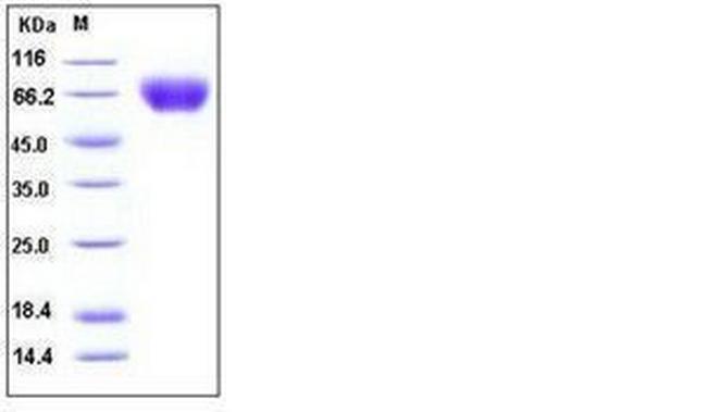 Human ICAM-1 (CD54) His-tag Protein