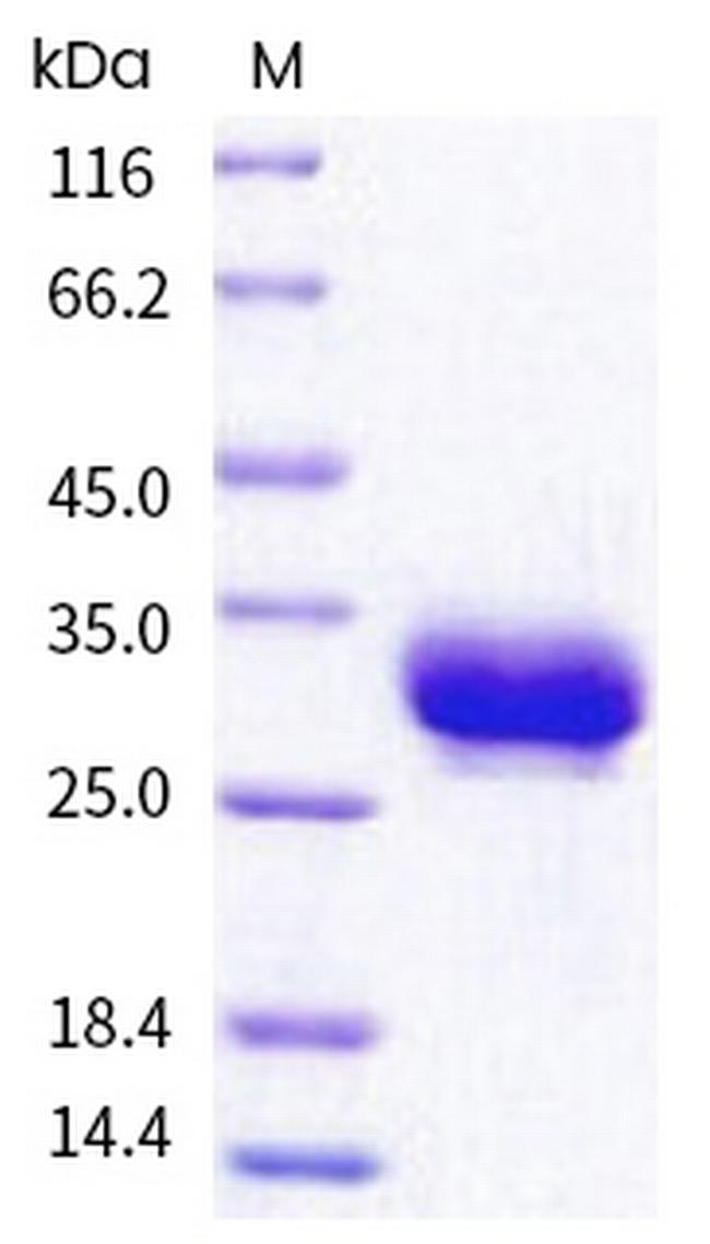 Human Fc gamma RIIA (CD32a) (167 Arg/His) His-tag Protein