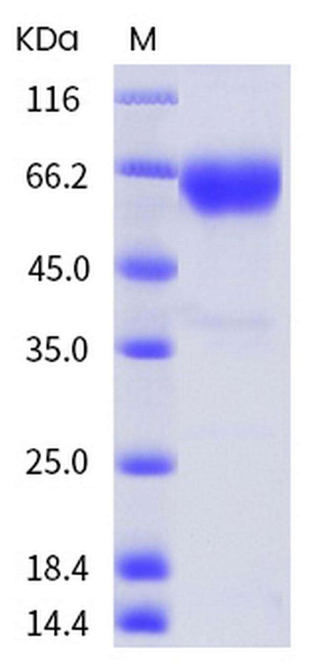 Human PD-1 His-tag Fc Chimera Protein