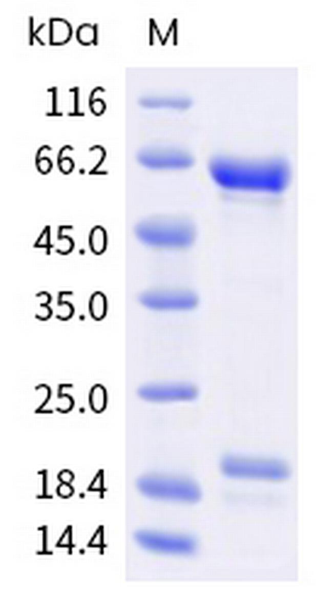 Human PCSK9 (NARC1) His-tag Protein