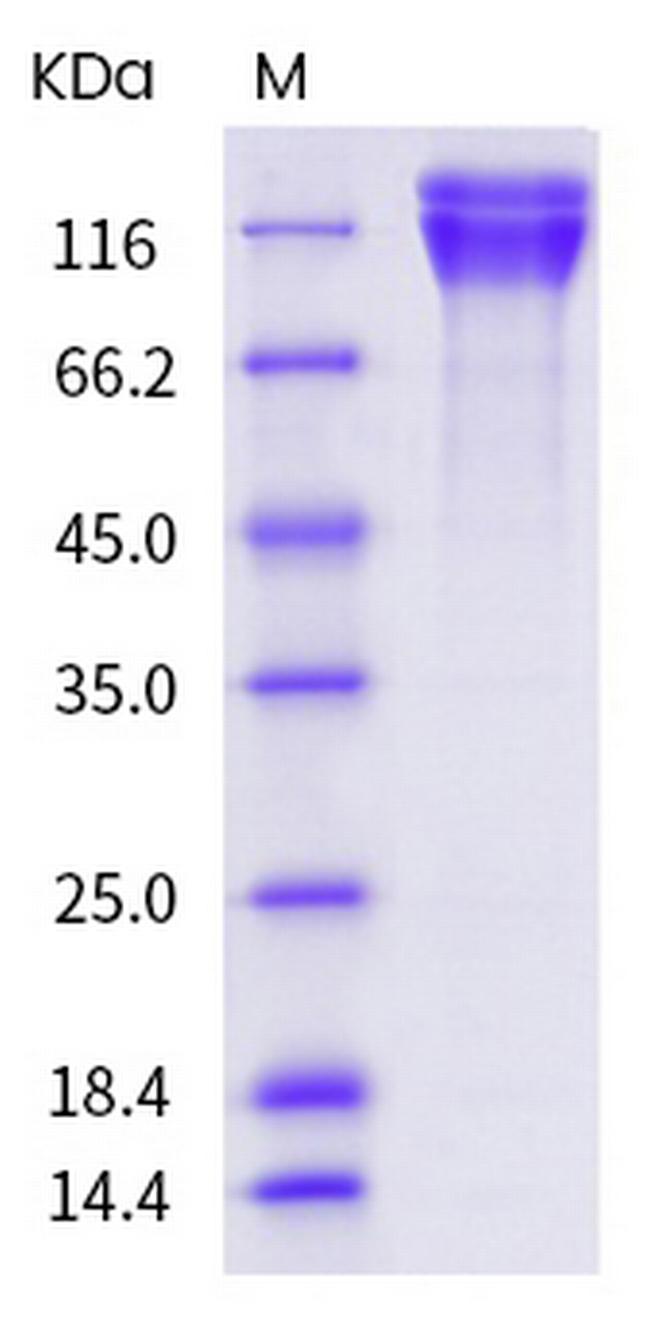 Human CEACAM5 (CD66e) Protein