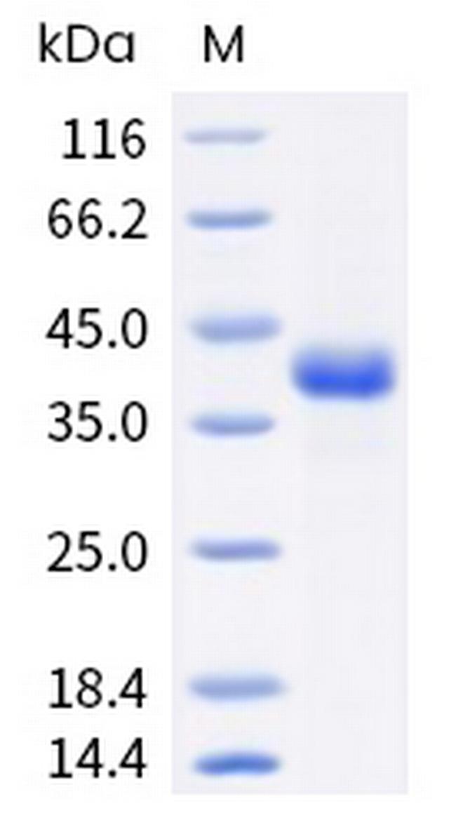 Human R-Spondin 1 (aa 1-263) Protein