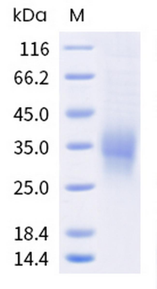 Human TREM-2 His-tag Protein