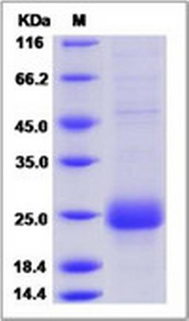 Human CTLA-4 His-tag Protein