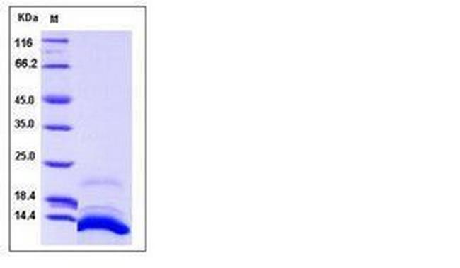 Human CXCL12 His-tag Protein