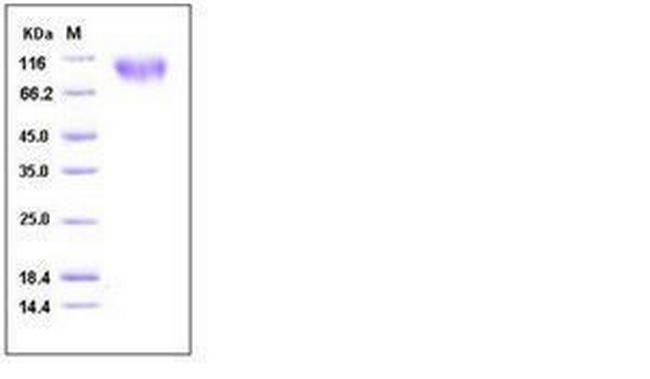 Mouse CD155 (PVR) His-tag Fc Chimera Protein