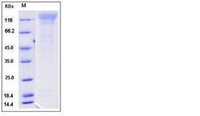 Mouse CD96 His-tag Protein