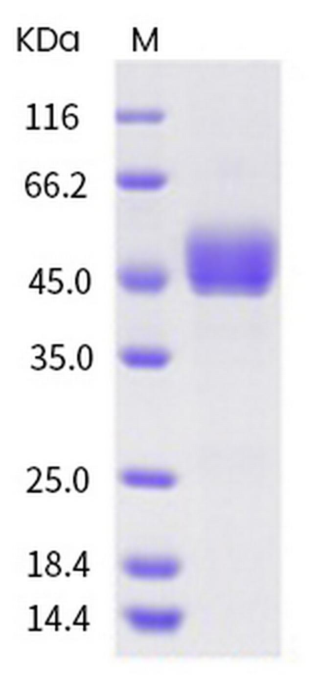Human CD3D His-tag/CD3E DYKDDDDK-tag Fc Chimera Protein