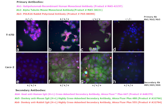 Human IgG (H+L) Cross-Adsorbed Secondary Antibody in Immunocytochemistry (ICC/IF)
