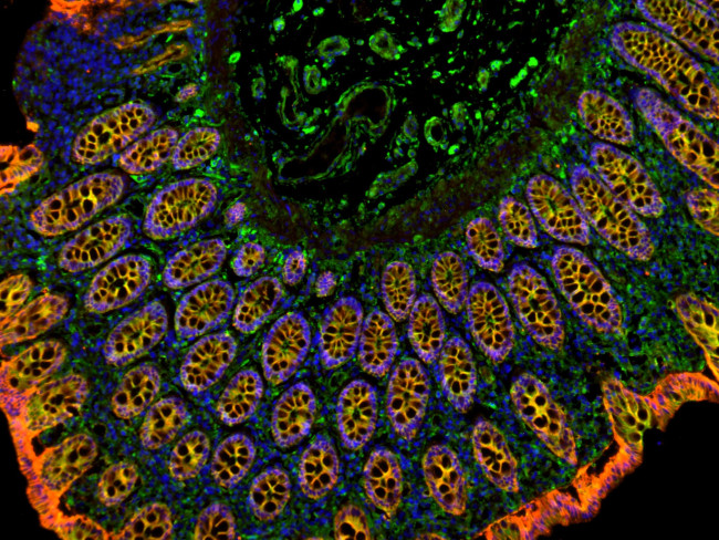 Rabbit IgG (H+L) Cross-Adsorbed Secondary Antibody in Immunohistochemistry (Paraffin) (IHC (P))