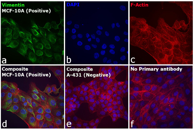 Rabbit IgG (H+L) Cross-Adsorbed Secondary Antibody in Immunocytochemistry (ICC/IF)