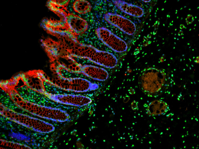 Mouse IgG (H+L) Cross-Adsorbed Secondary Antibody in Immunohistochemistry (Paraffin) (IHC (P))