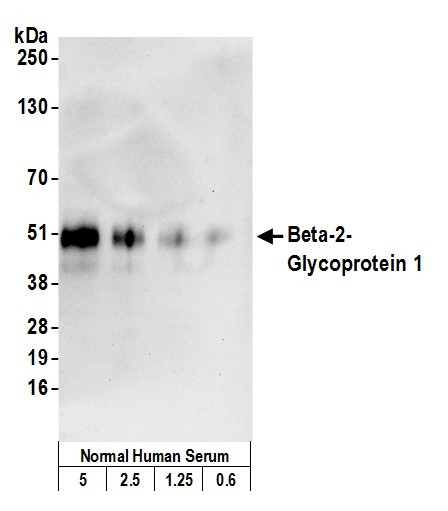 Beta-2-Glycoprotein 1 Antibody in Western Blot (WB)
