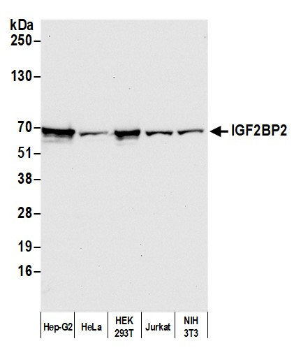 IGF2BP2 Antibody in Western Blot (WB)