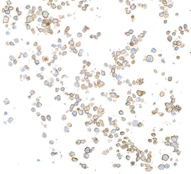CD20 Antibody in Immunocytochemistry (ICC/IF)