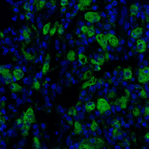 CD68 Antibody in Immunohistochemistry (Paraffin) (IHC (P))