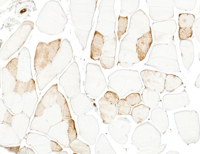Myoglobin Antibody in Immunohistochemistry (Paraffin) (IHC (P))