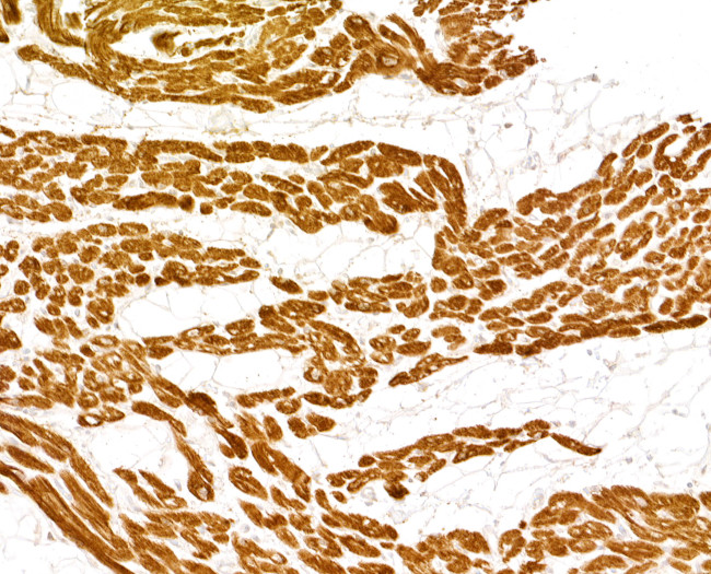 Cardiac Troponin I Antibody in Immunohistochemistry (Paraffin) (IHC (P))
