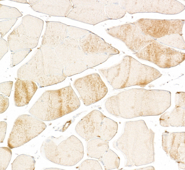 Skeletal Troponin I Antibody in Immunohistochemistry (Paraffin) (IHC (P))