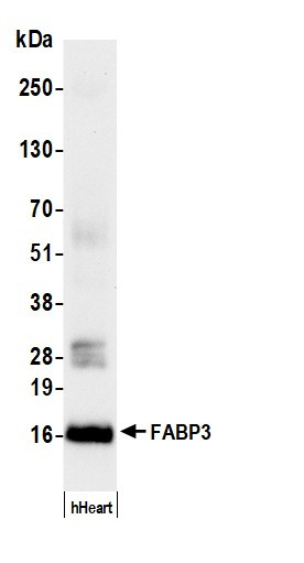 FABP3 Antibody in Western Blot (WB)