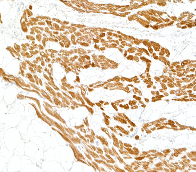 Cardiac Troponin I Antibody in Immunohistochemistry (Paraffin) (IHC (P))