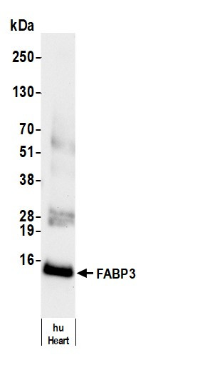FABP3 Antibody in Western Blot (WB)
