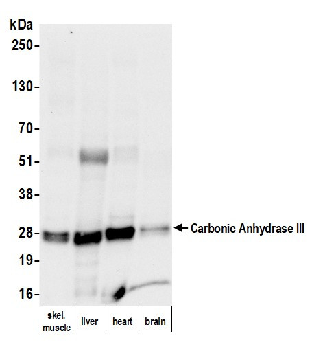 Carbonic Anhydrase III Antibody in Western Blot (WB)