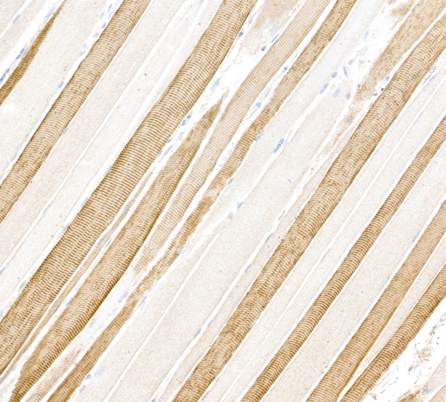 Myosin Light Chain 1 Antibody in Immunohistochemistry (Paraffin) (IHC (P))