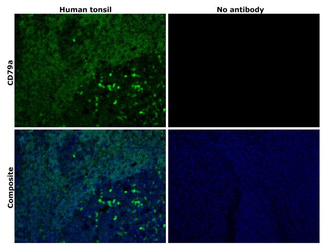 CD79a Antibody in Immunohistochemistry (Paraffin) (IHC (P))