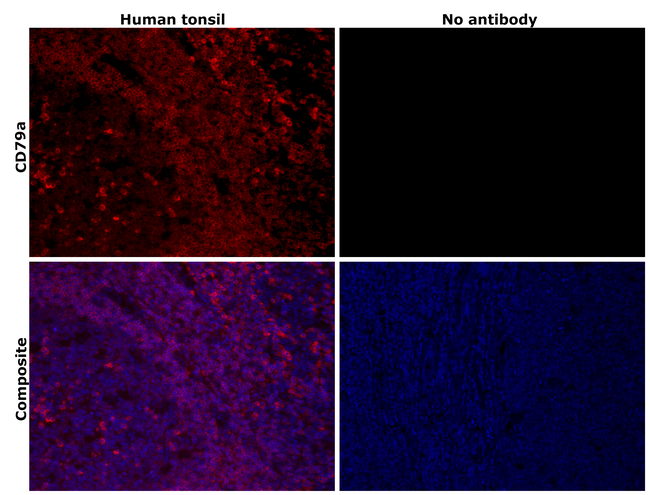 CD79a Antibody in Immunohistochemistry (Paraffin) (IHC (P))