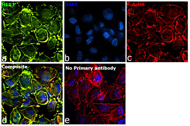 Human IgG (Kappa Light Chain) Secondary Antibody in Immunocytochemistry (ICC/IF)