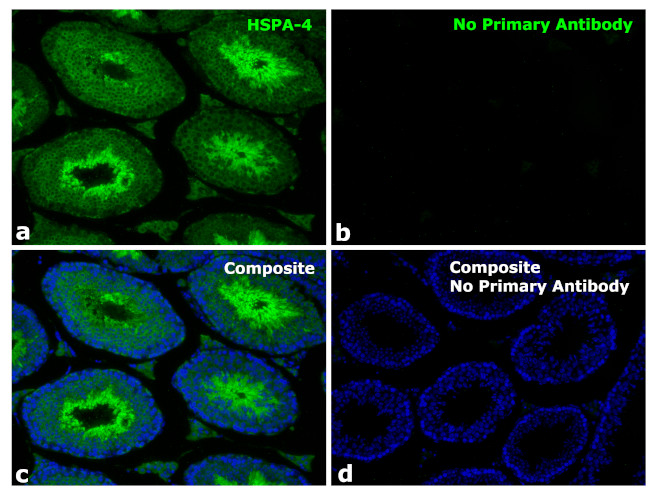 Human IgG Fab Secondary Antibody in Immunohistochemistry (Paraffin) (IHC (P))