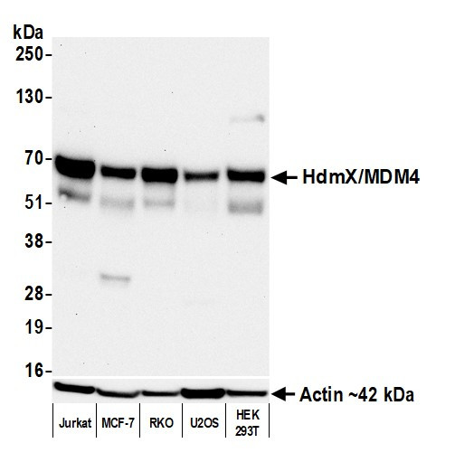 HdmX/MDM4 Antibody in Western Blot (WB)