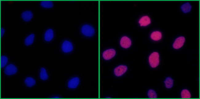 Phospho-RPA32 (Ser4, Ser8) Antibody in Immunocytochemistry (ICC/IF)