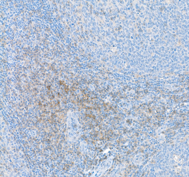 CD4 Antibody in Immunohistochemistry (IHC)