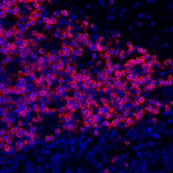 CD3E Antibody in Immunohistochemistry (Paraffin) (IHC (P))