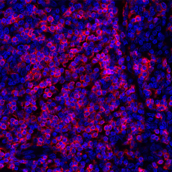 CD247/CD3Z Antibody in Immunohistochemistry (Paraffin) (IHC (P))