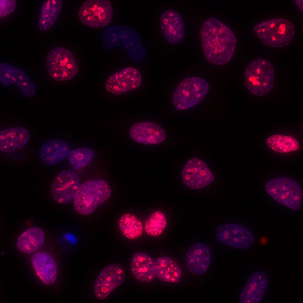 Ki-67 Antibody in Immunocytochemistry (ICC/IF)