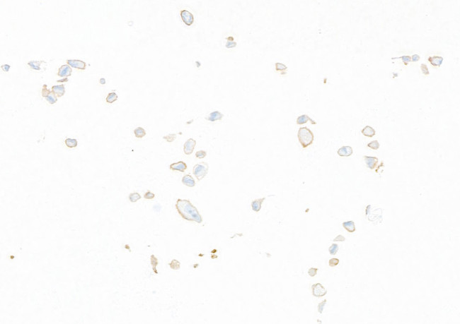 B7-H3/CD276 Antibody in Immunocytochemistry (ICC/IF)