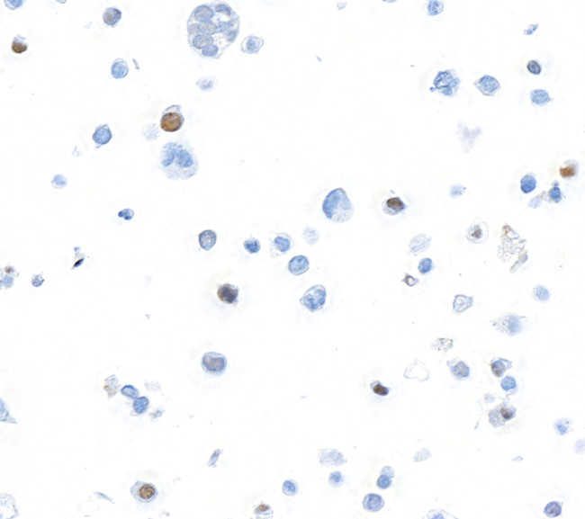 FOXP3 Antibody in Immunocytochemistry (ICC/IF)