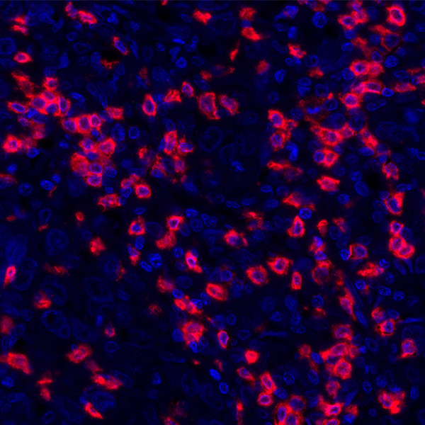CD8 alpha Antibody in Immunohistochemistry (Paraffin) (IHC (P))